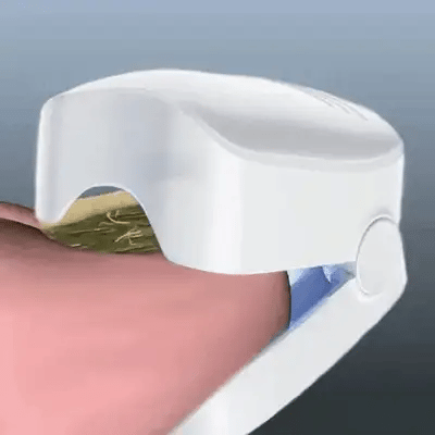Pack Fongara™ — Élimine la Mycose des Ongles en 7 Minutes / Jour